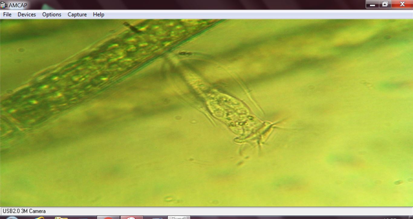 chi � questa vorticella con guscio?